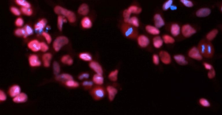 cls-nucleus-the-growing-role-of-mscs-in-regenerative-medicine