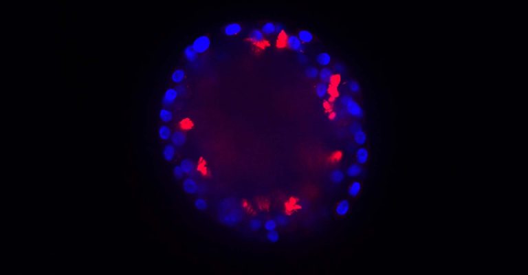 Using Organoids for Disease Modeling