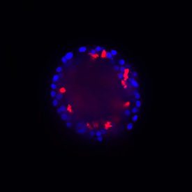 Blue and yellow organoid image