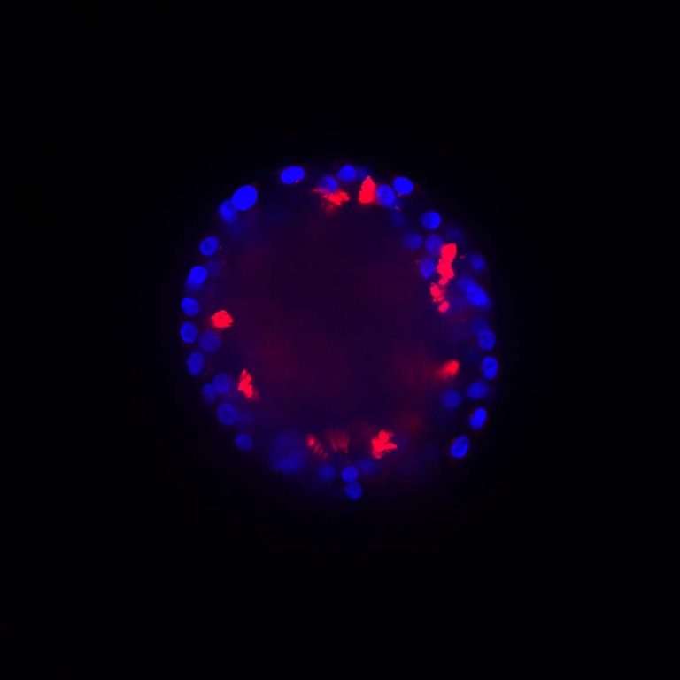 Blue and yellow organoid