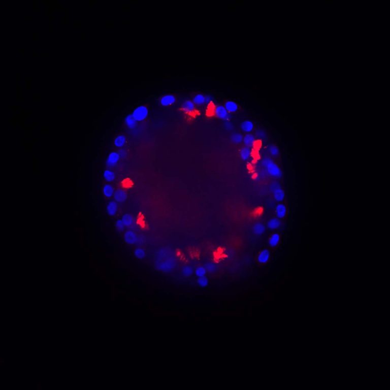 cls-nucleus-using-organoids-for-disease-modeling-sq.jpg