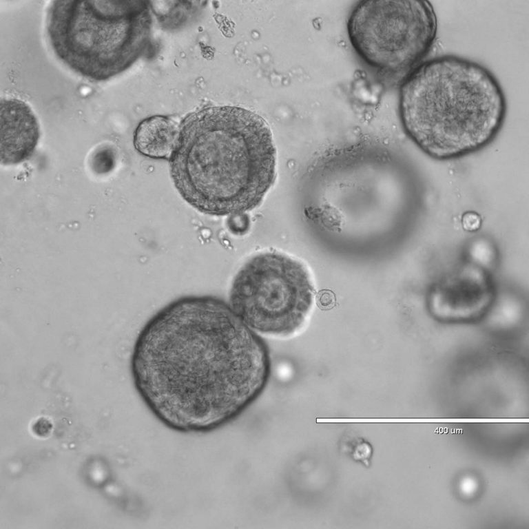 organoids