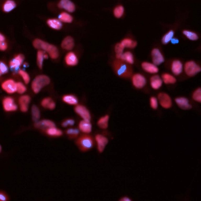 Stem Cell Differentiation