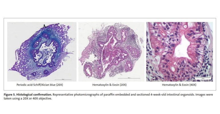 A Novel Method for Generating Single, Intestinal Organoids for High Throughput Screening