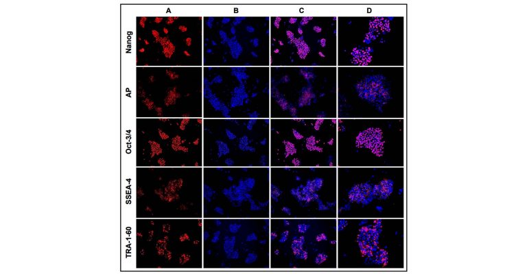 Maintenance of Human iPS Cells in a Feeder-free Culture System