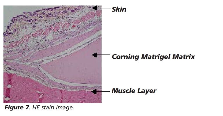 Methods for Implantation of Corning Matrigel Matrix into Mice and Tissue Fixation