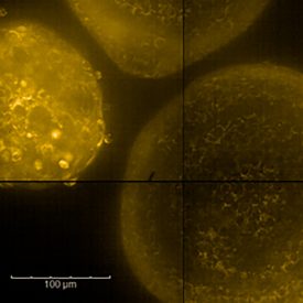 Patient-derived tumor organoids at 63X stained using MITOTRACKER Image © Genesis Lara Granados