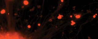 Streamline and simplify 3D multicellular spheroid formation